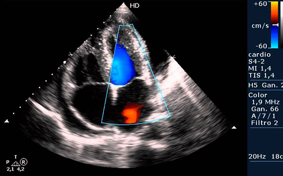 ECOCARDIOGRAMA – Prevent Medicina